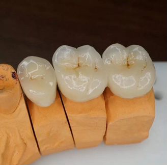 Зубной техник-керамист