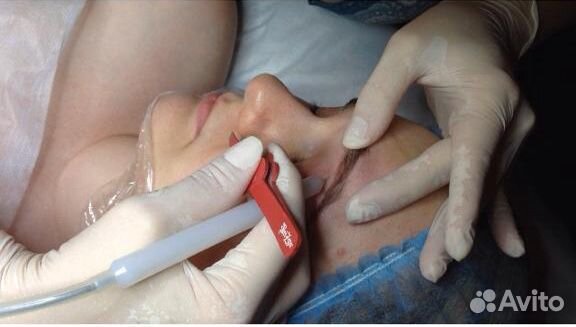 Обучение электроэпиляции /электроэпиляция