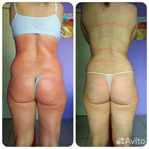 Массаж-коррекция фигуры